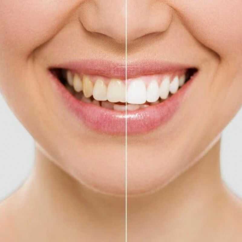 SUPER PROMOCIÓN 2X1 🎁 Lápiz Corrector de Color - Whithening Pen